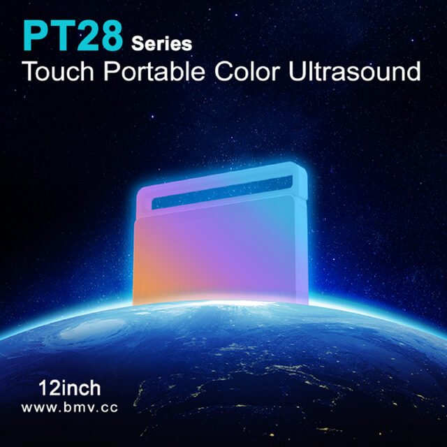 PulseTouch™PT28 12inch Touch Color Doppler Point-of-Care Imaging Ultrasound System